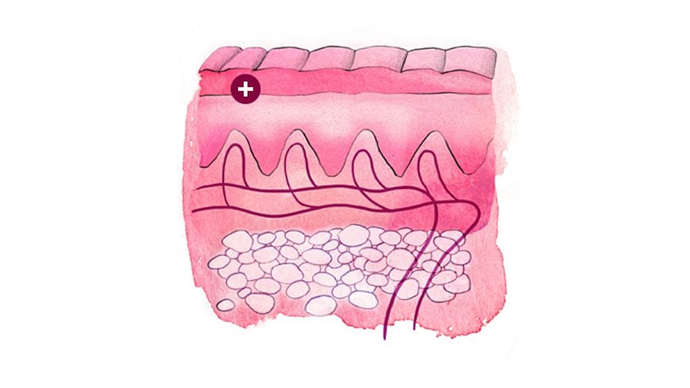 Illustration eines Hautquerschnitts: Hornschicht