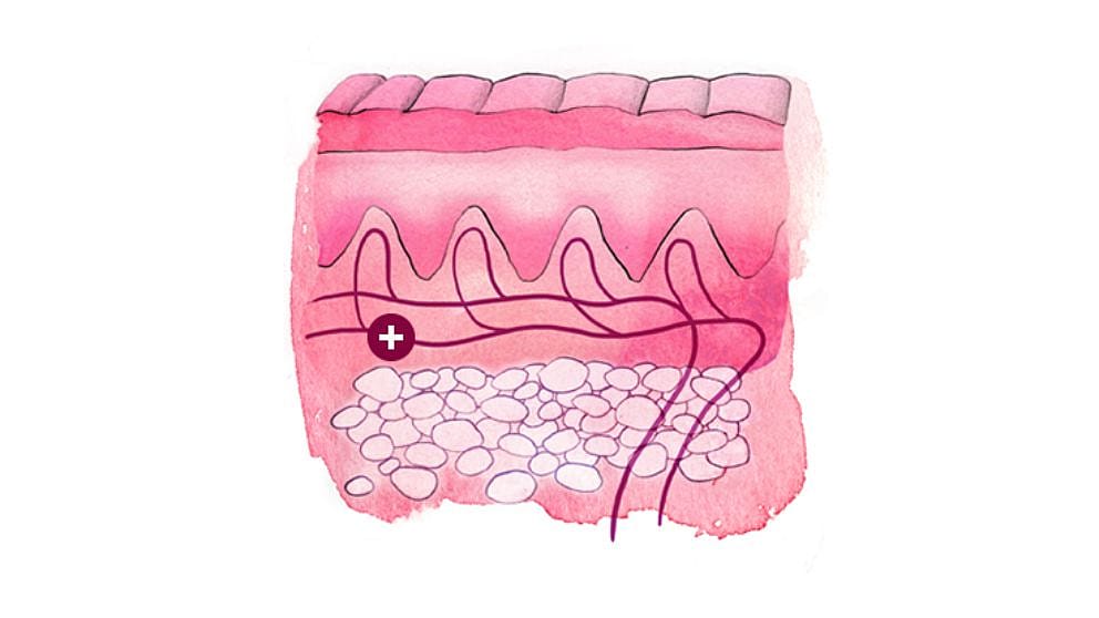 Illustration eines Hautquerschnitts: Lederhaut