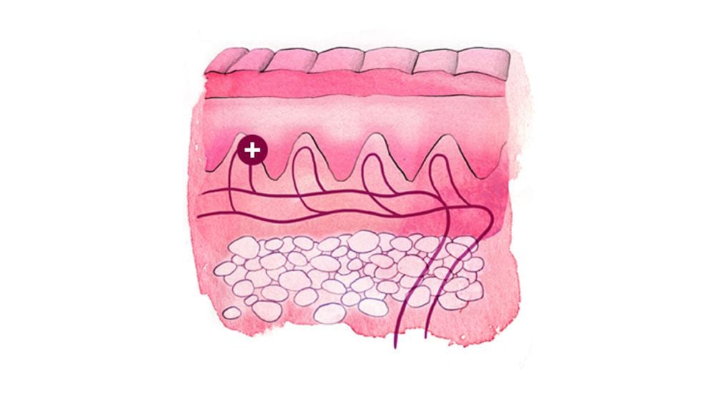 Illustration eines Hautquerschnitts: Oberhaut