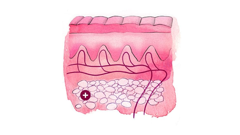Illustration eines Hautquerschnitts: Unterhaut